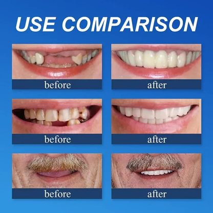 Offer ends today: 50% off! ⏰50% off! KLENIMORE™ Medical Grade, Strong Adhesion, Custom Fit